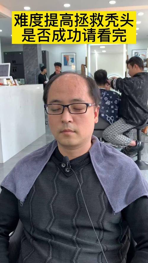 秃顶剪什么发型