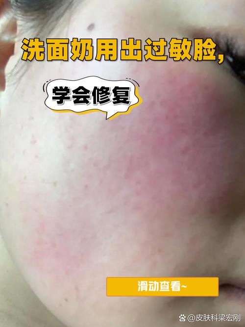 玛德兰护肤品会过敏吗