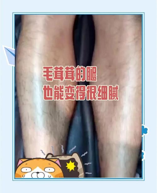 为什么腿毛会掉