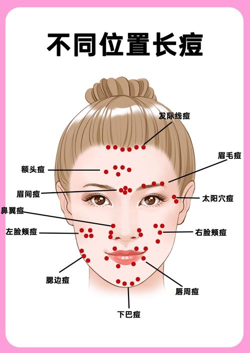 右脸长痘什么原因