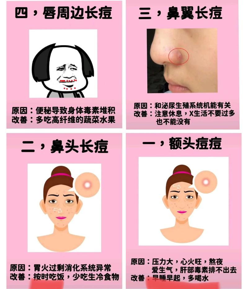 右脸长痘什么原因