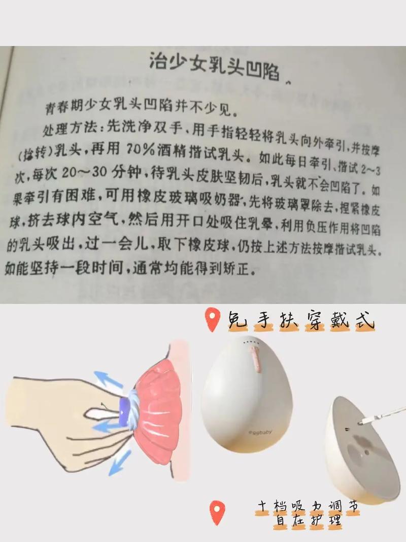 乳头内陷什么原因