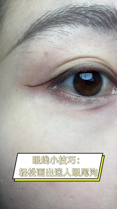 眼尾沟是什么
