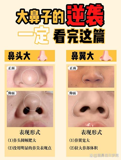 为什么鼻头大