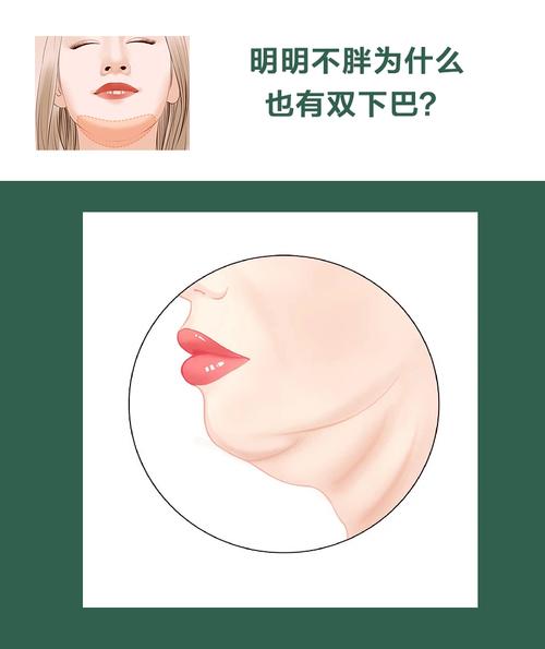 什么是双下巴