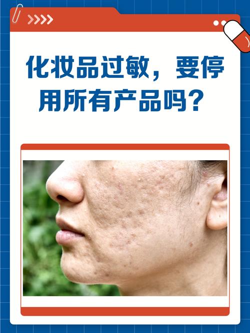 换护肤品期间要停几天