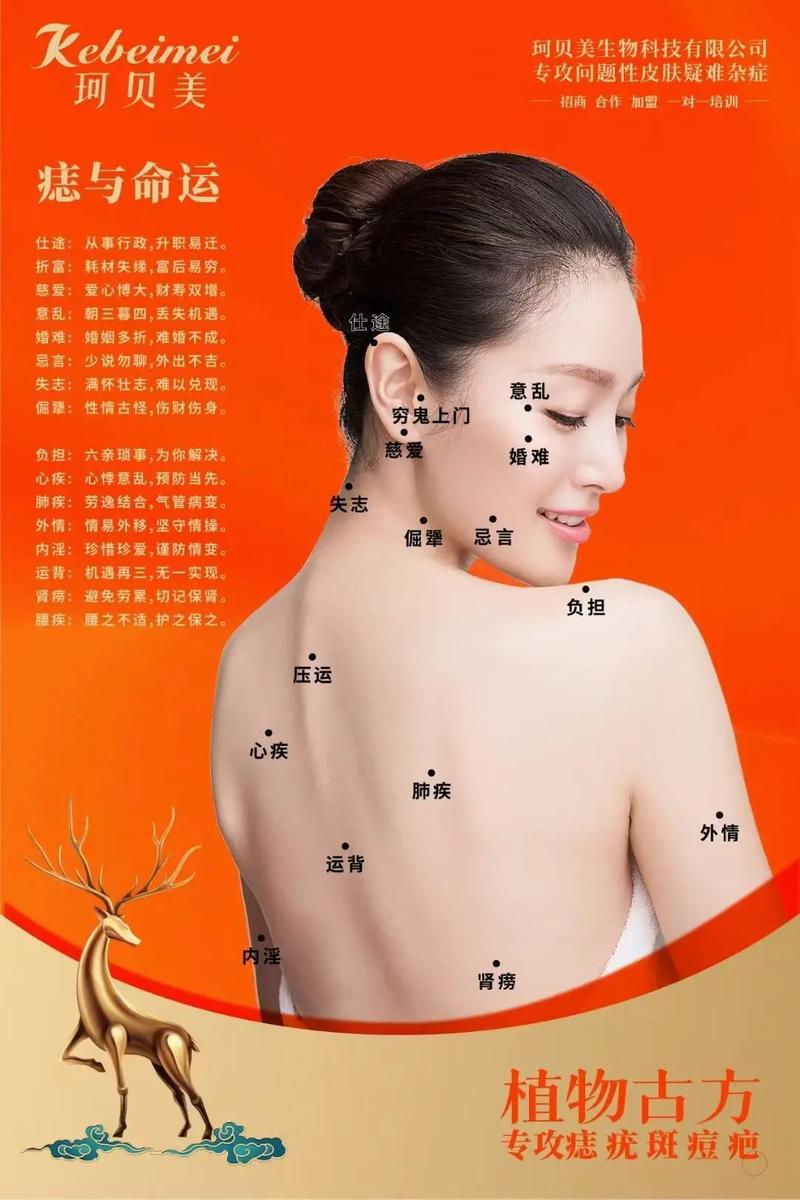 背上长痣代表什么