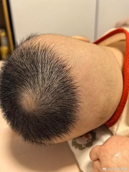 为什么头发长不长