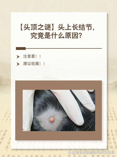 为什么头上长疙瘩
