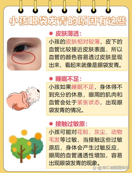 眼袋发青什么原因