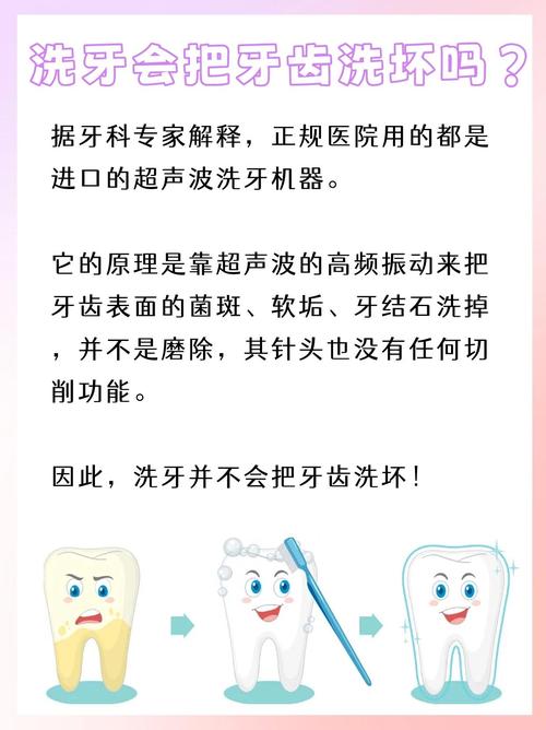 洗牙原理是什么