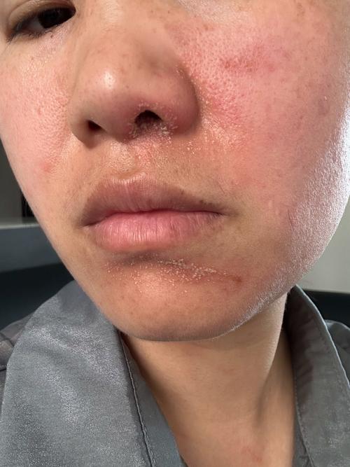 脸很油腻用什么护肤品