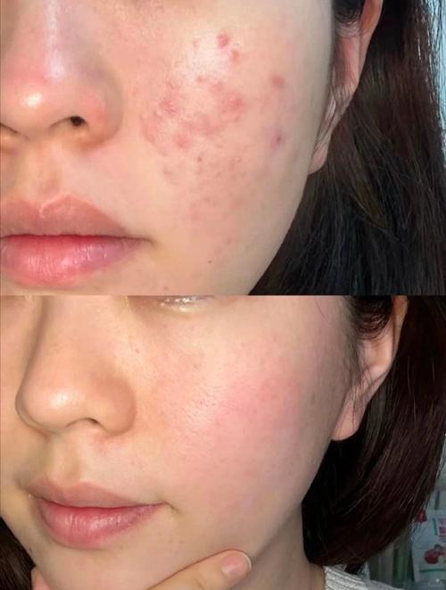 脸很油腻用什么护肤品