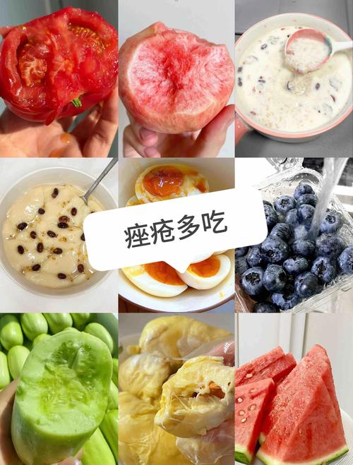 吃什么容易长痘痘