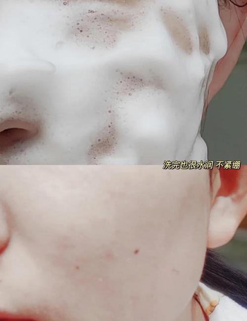 用洗面奶后脸干燥紧绷