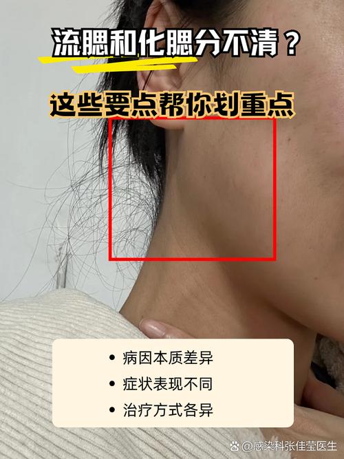 腮帮是什么意思