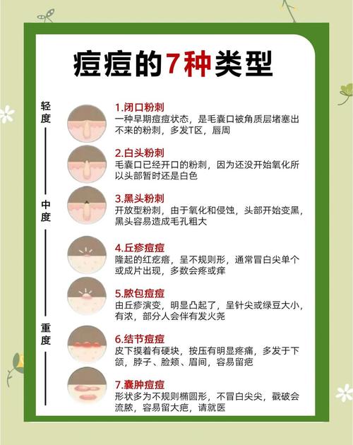 长痘痘的原因是什么