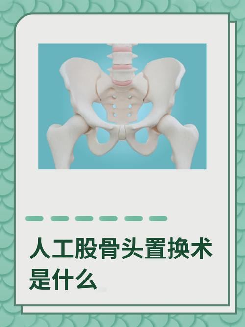 人工骨是什么