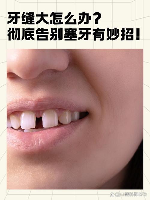 为什么会有牙缝