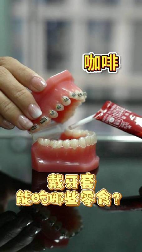 箍牙能吃什么