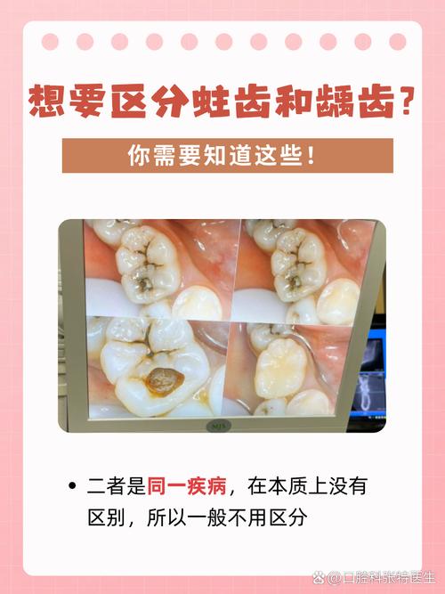 为什么会有虫牙