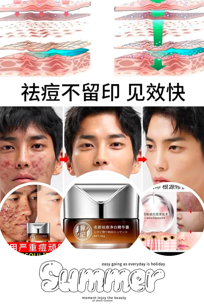 有痘印可以用护肤品吗