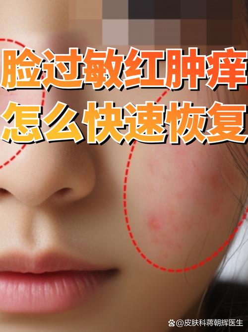 过敏能用洗面奶洗脸吗