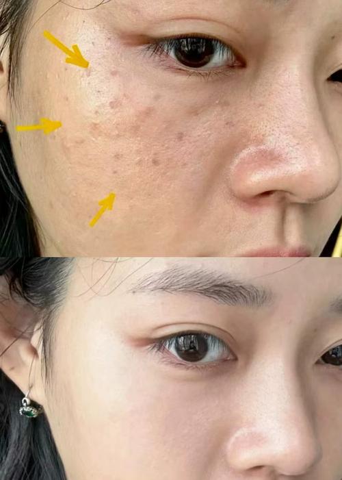 脸上长斑用那种护肤品