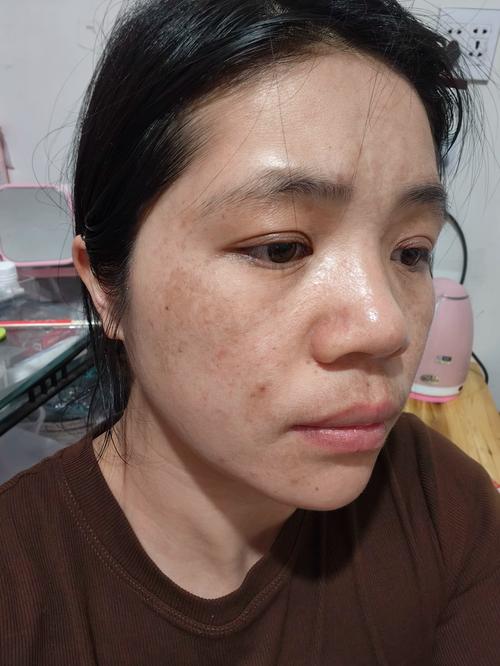 脸上长斑用那种护肤品