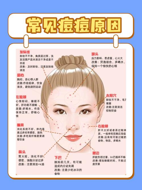 为什么下巴会长痘