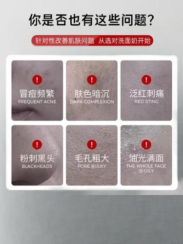 粉刺能用军献洗面奶