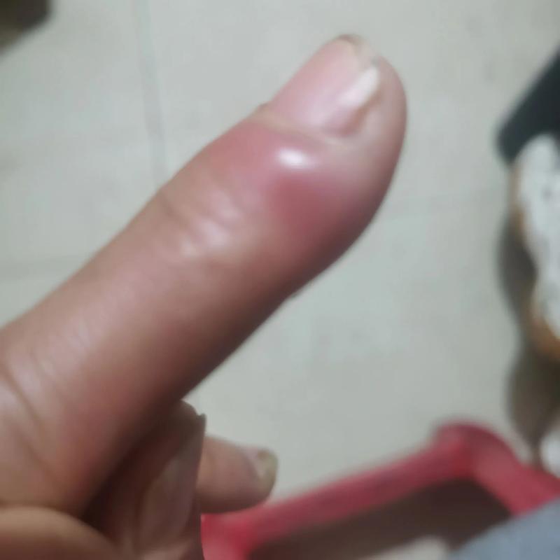 肿了是什么意思