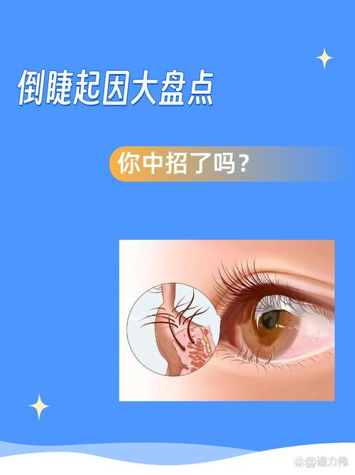 为什么掉眼睫毛