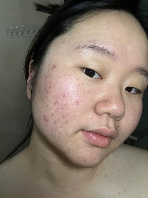 洗面奶洗多了脸干了