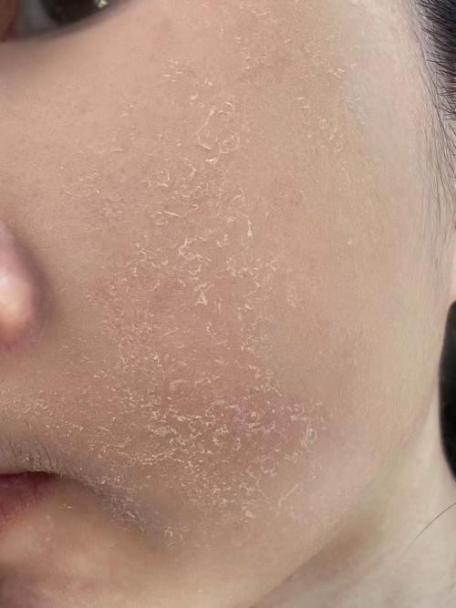 洗面奶用完以后脸白