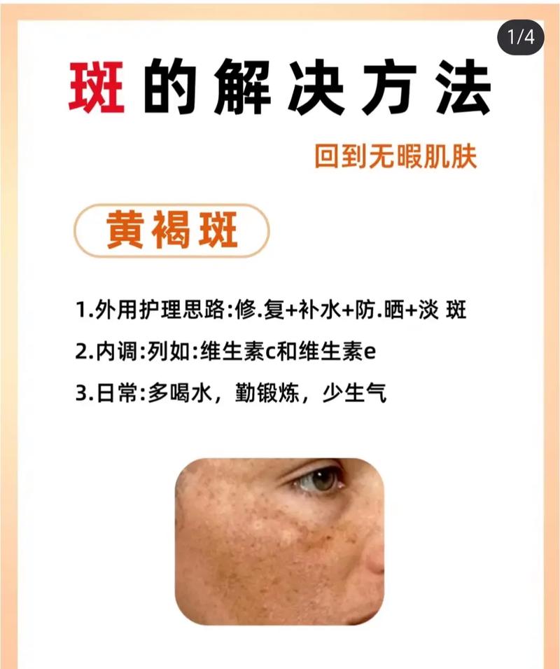 祛斑什么方法最好