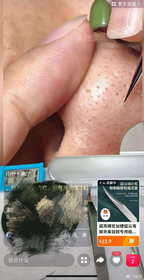 洗面奶的磨砂进眼里