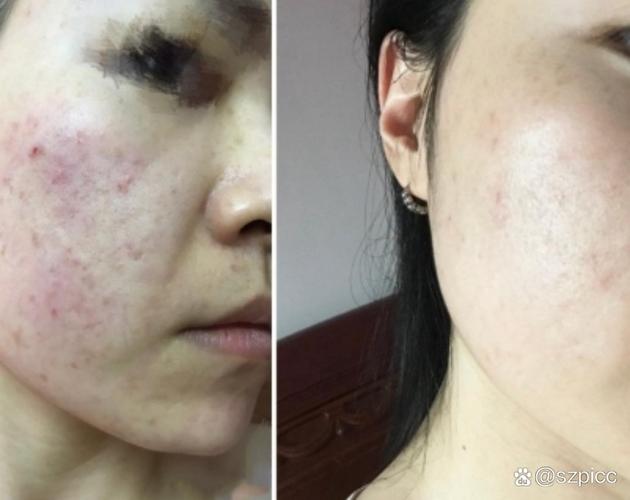 去角质洗面奶dhc