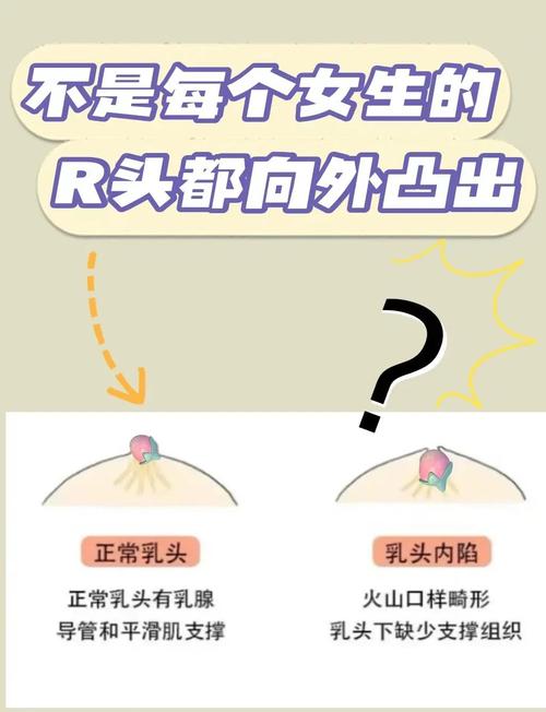 正常乳头什么样