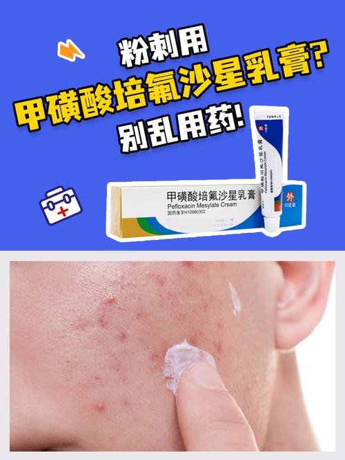 长粉刺吃什么药