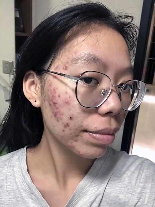 卸完妆忘记用洗面奶