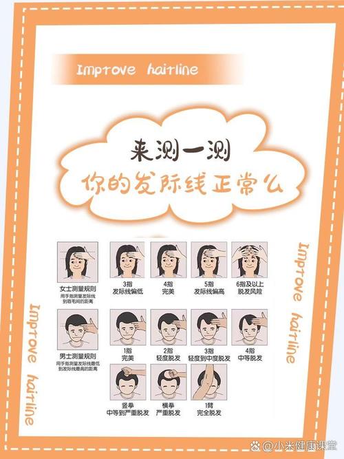 发际线是什么意思