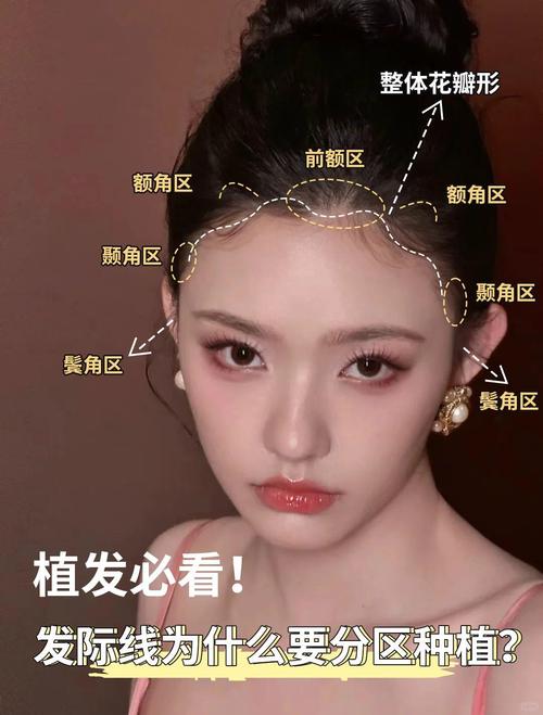 发际线是什么意思