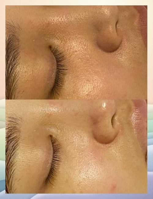 t区油是什么肤质