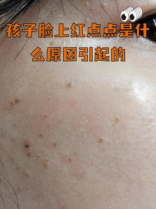 布朗熊洗面奶过敏吗