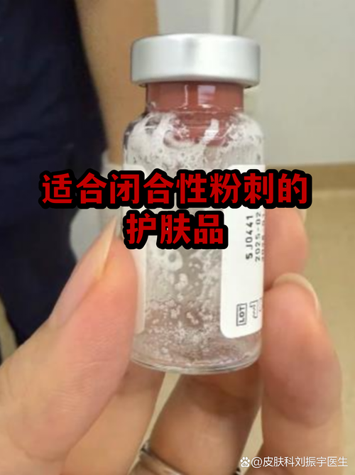 治疗闭合粉刺 护肤品