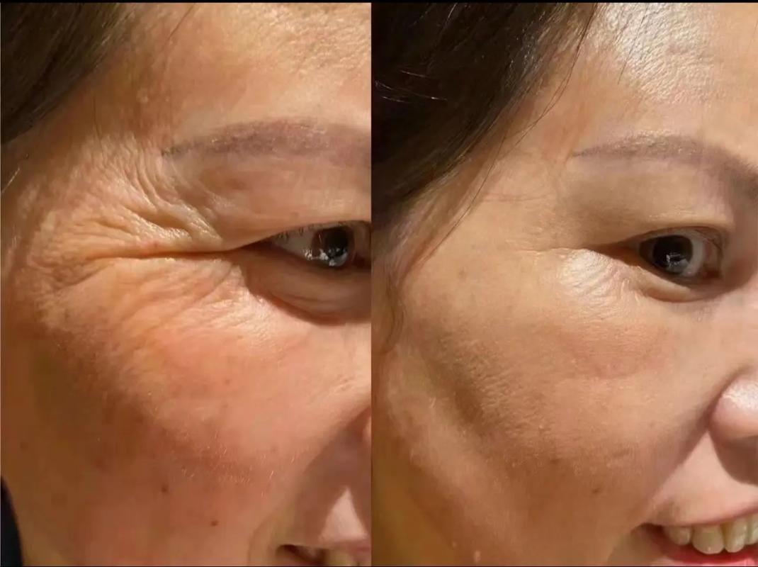 为什么皮肤会松弛