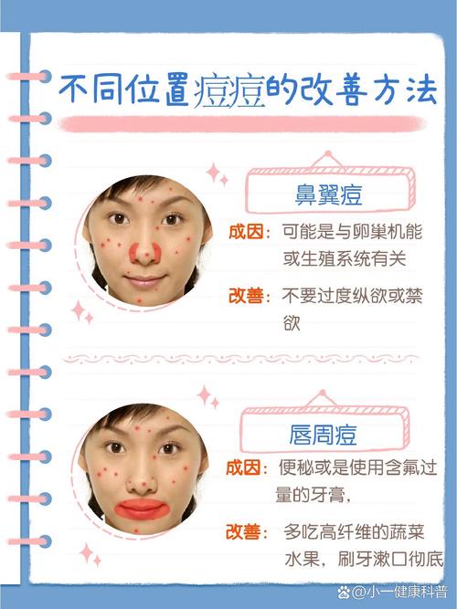 为什么鼻子长痘