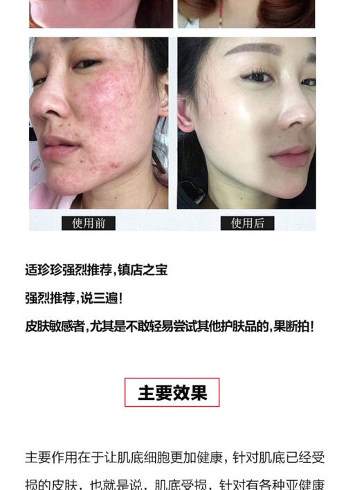 脸过敏了能擦护肤品吗