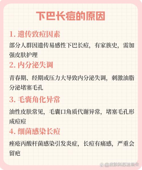 下巴起痘什么原因